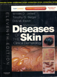 Image of Andrews' Diseases of the Skin