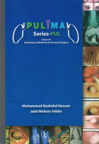 Image of PULIMA Series- PUL