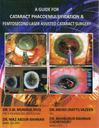 Image of A Guide for Cataract Phacoemulsification & Femtosecond Laser Assisted Cataract Surgery