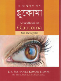 Image of A Handbook on Glaucoma